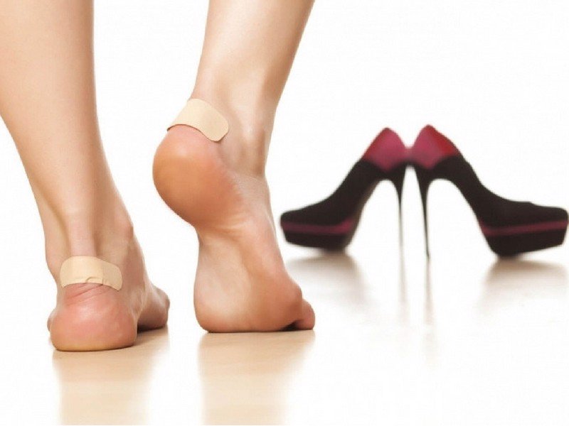 Trầy da gót chân khi đeo giày cao gót