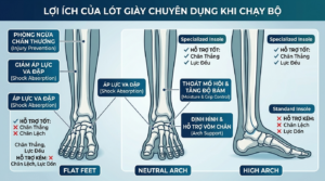 *Hình 2: Nhận biết 3 dạng vòm bàn chân phổ biến để chọn lót giày tương thích.